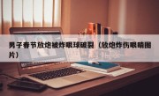 男子春节放炮被炸眼球破裂（放炮炸伤眼睛图片）