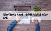 烫伤的疤痕怎么去除（卷发棒烫伤的疤痕怎么去除）