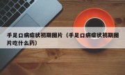 手足口病症状初期图片（手足口病症状初期图片吃什么药）